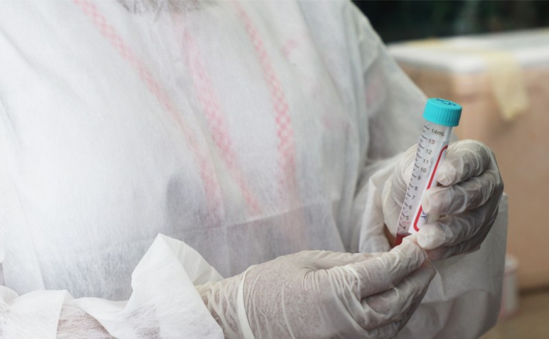 Cenário epidemiológico da Covid-19 no Amazonas é divulgado pela FVS-RCP, neste domingo (09/01)