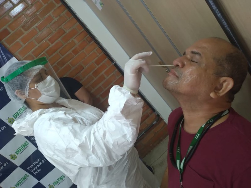 Fundação Estadual do Índio realiza exames de Covid-19 em servidores