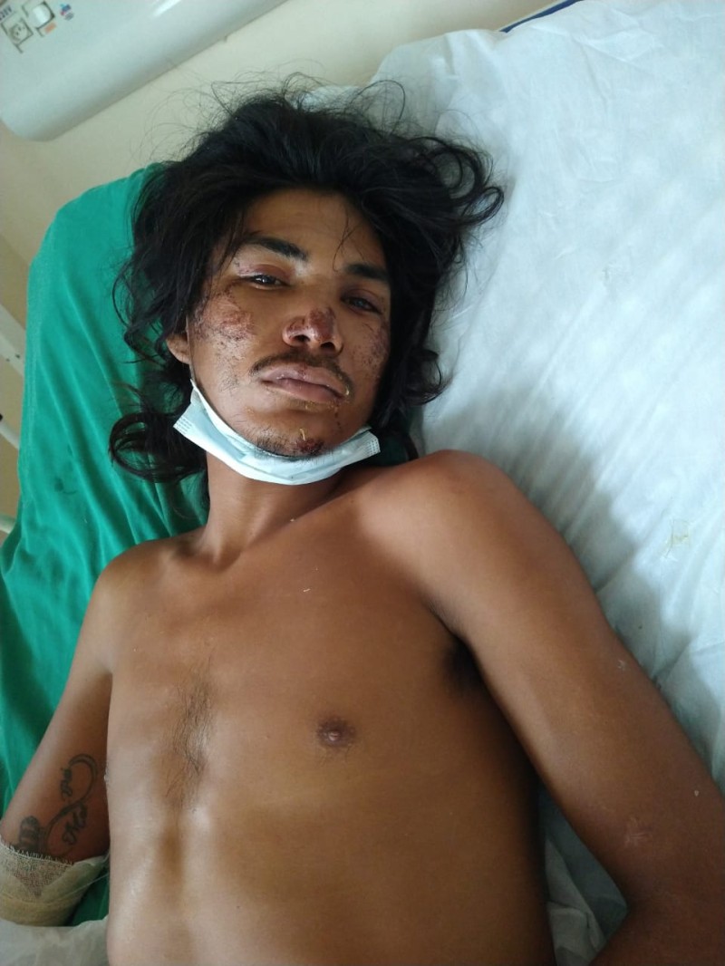 HPS João Lúcio procura familiares de paciente internado na unidade vítima de agressão