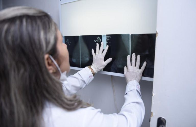 Centro de Controle Oncológico busca mais de 1,5 mil pacientes que não retiraram resultados de exames