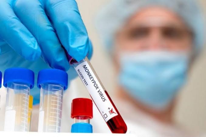 Saúde notifica caso suspeito de monkeypox