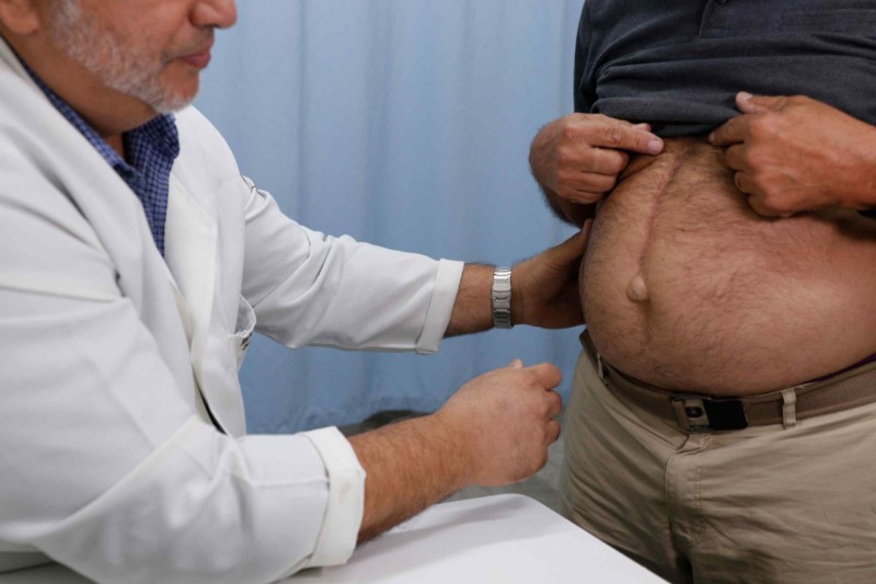 Hérnia: mais de 9 mil fizeram cirurgia no Amazonas