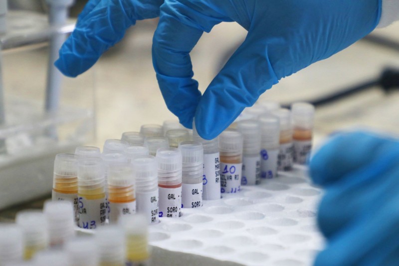 Mpox: Informe semanal atualiza situação da doença no Amazonas, nesta terça-feira