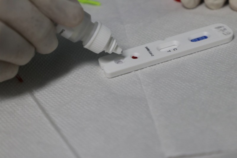Cenário epidemiológico da Covid-19 no Amazonas é divulgado pela FVS-RCP, nesta sexta-feira (30/07)