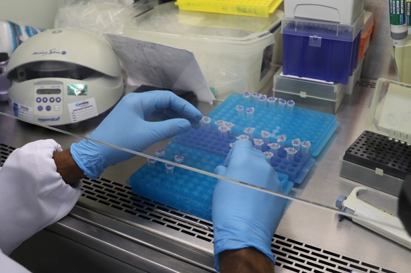 Panorama epidemiológico da Covid-19 no Amazonas é atualizado pela FVS-RCP, nesta quarta-feira (04/08)
