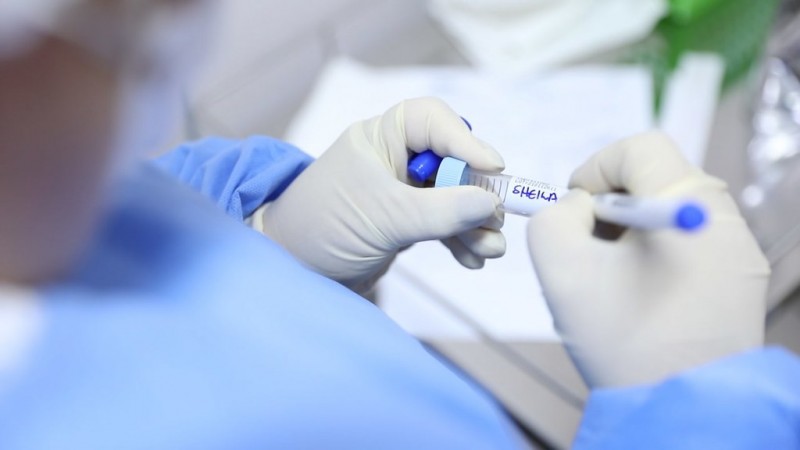 Cenário epidemiológico da Covid-19 no Amazonas é divulgado pela FVS-RCP, neste domingo (05/09)